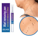 Wart Removal Mole Remedy Liquid Pen Treatment Papillomas Removing Skin Labels Flat Wart Genitals Painless Beauty Herbal Cream