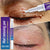 Wart Removal Mole Remedy Liquid Pen Treatment Papillomas Removing Skin Labels Flat Wart Genitals Painless Beauty Herbal Cream
